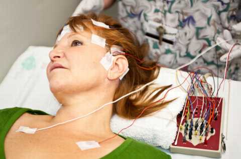 Mediterranean Diet prevents brain ictus