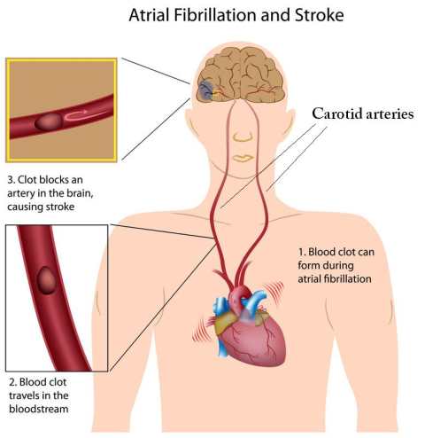 Carotid arteries image